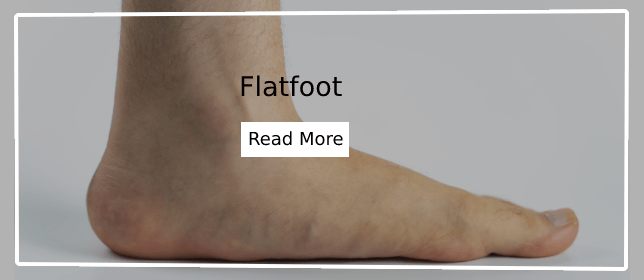 Common Foot Problems - Flat foot