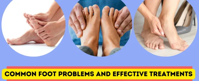 Foot Problems and effective treatment