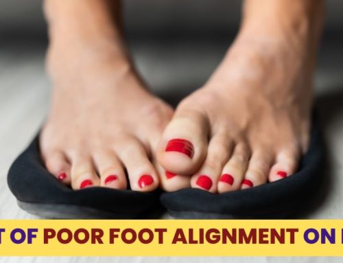 How Does Poor Foot Alignment Cause Problems?