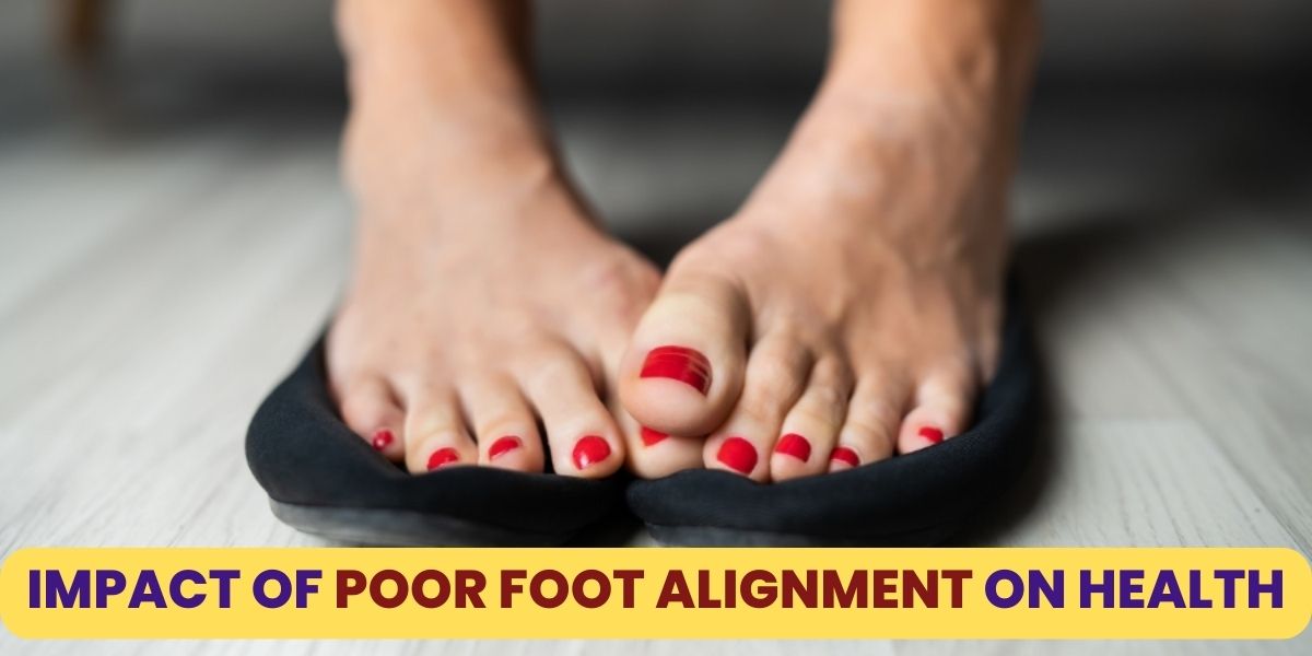 How Does Poor Foot Alignment Cause Problems? - Pacific Foot