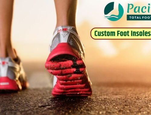 Custom Foot Insoles for Athletes: Maximizing Performance and Preventing Injuries