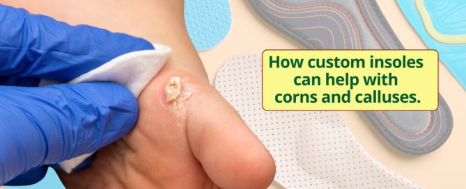 How custom insoles can help with corns and calluses.