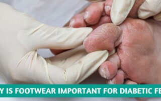 Why is Footwear Important for Diabetic Feet?