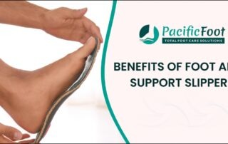 Advantages of Foot Arch Support Slippers