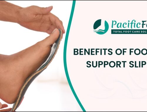 Benefits of Foot Arch Support Slippers