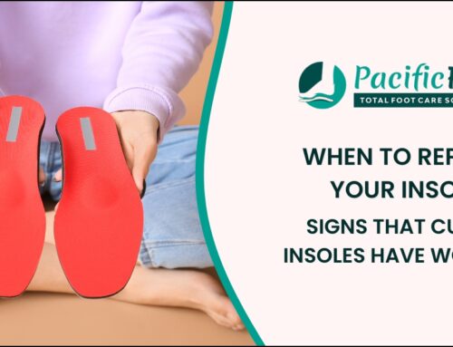 When to Replace Your Insoles: Signs That Custom Insoles Have Worn Out