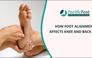 Foot Alignment Issue