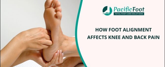 Foot Alignment Issue