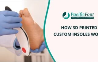 3D printed Custom Insoles
