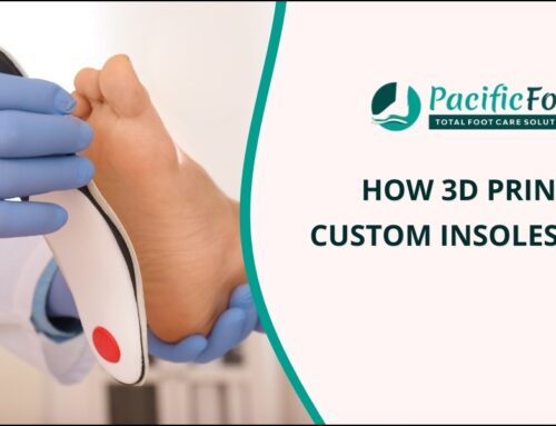 How 3D printed custom insoles work?
