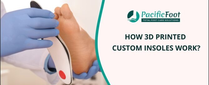 3D printed Custom Insoles